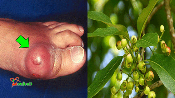 công dụng của nụ vối